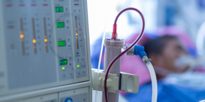 Early dialysis in the critical