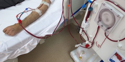 ACCESS-dialysis