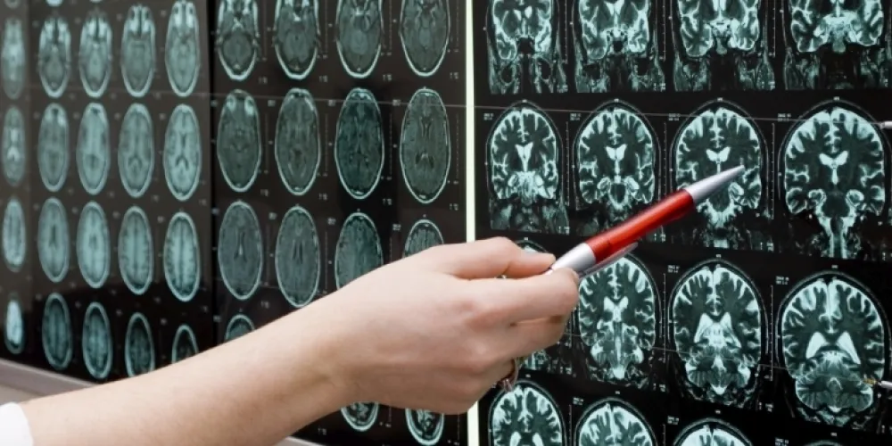 Major global study highlights improved